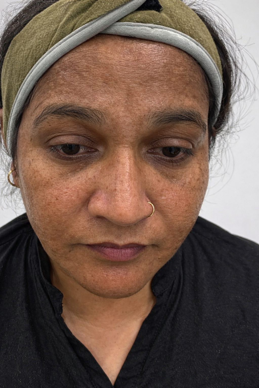 Before using Mishteek Organics product