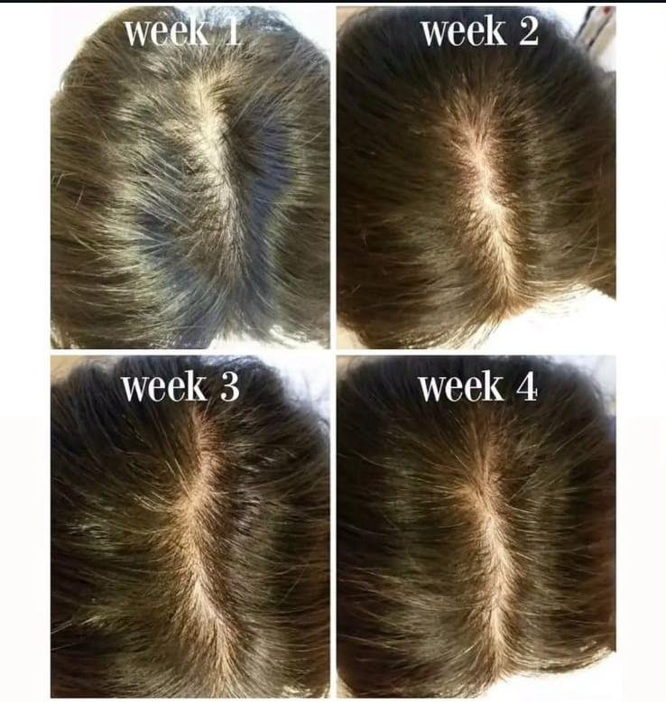 Mishteek Hair Growth Oil - Image 4