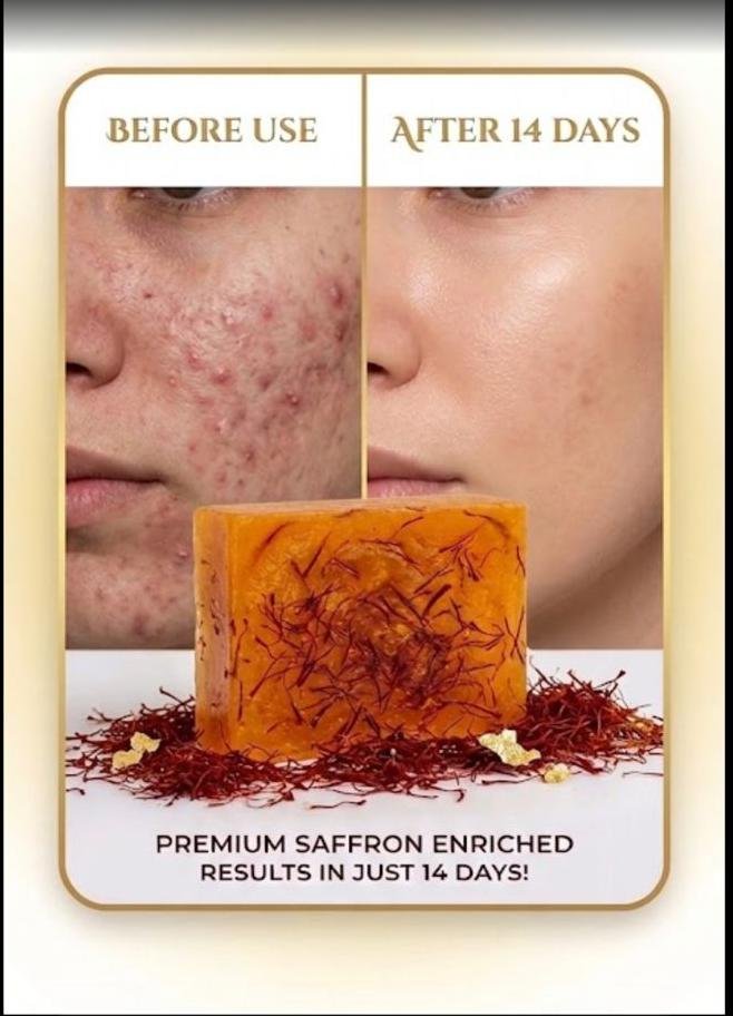 Saffron Acne Cool Soap - Image 2